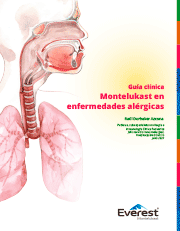 Guía clínica Montelukast en enfermedades alérgicas