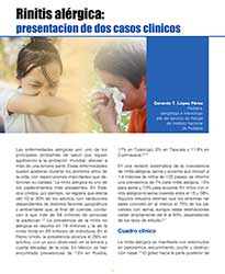 Rinitis alérgica: presentación de dos casos clínicos